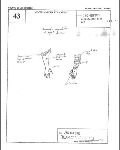 kobe and gigi autoposy|Kobe Bryant Autopsy Report